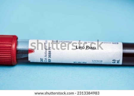 Lipid Panel This Test measures cholesterol levels, including total cholesterol, LDL cholesterol, HDL cholesterol, and triglycerides.