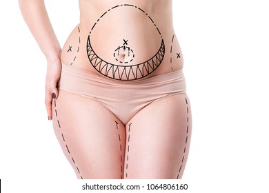 Liposuction, fat and cellulite removal concept, overweight female body with painted lines and arrows, isolated on white background - Shutterstock ID 1064806160