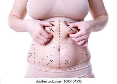 Liposuction, fat and cellulite removal concept, overweight female body with painted lines and arrows, isolated on white background