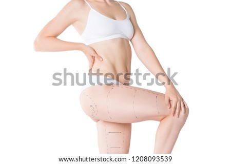 Liposuction, fat and cellulite removal concept, overweight female body with painted lines and arrows, isolated on white background