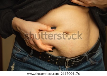Lipotropic injections close up. Belly fat dissolving treatment. Pendulous Abdomen. Women body after pregnancy. Obesity disease.