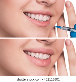 Similar Images, Stock Photos & Vectors of Photo of female open mouth
