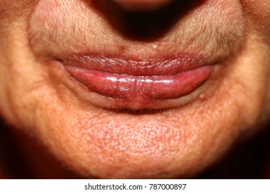 hairy wrinkled lips Hairy wrinkled lips