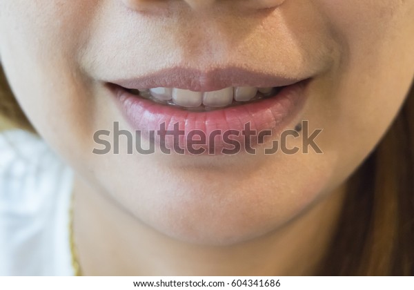 Lips Smile Teeth Lips Mole Stock Photo (Edit Now) 604341686