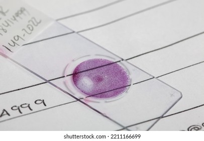 Liquid Based Cytology Microscope Slide For Pap Smear Test. Cervical Cancer Concept. Medical Concept.