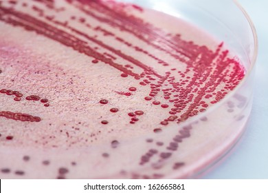 Listeria, bacteria in a petri dish, closeup - Powered by Shutterstock