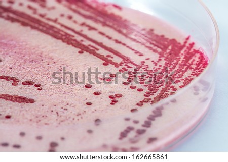 Listeria, bacteria in a petri dish, closeup
