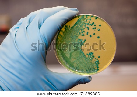 Listeria germs growing on an agar plate.