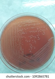 Listeria Monocytogenes Agar Plate