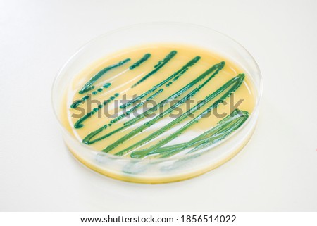 Listeria monocytogenes -  the most virulent foodborne pathogens - isolated on agar.