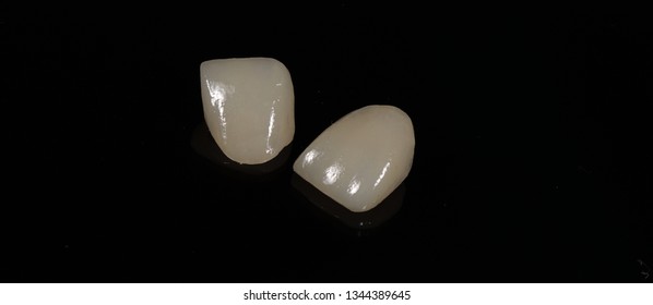 lithium disilicate dental crown