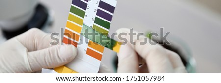 Litmus paper shows acidity, chemical analysis. Indicator for determining reaction medium. Strips and scraps filter paper tape. Most accurate measurement results. Use litmus paper in various fields