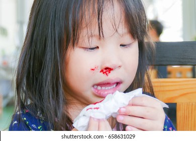 Little asian girl wipe her bleeding nose by tissue paper