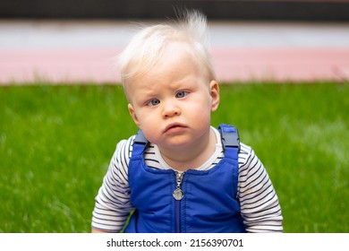 Little Baby Boy Portrait Of Child Outdoor With Strabismus Eyes