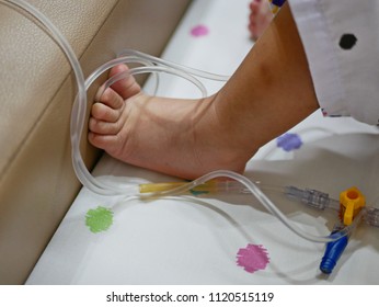 Little Baby Girl's Foot In Tangled Intravenous (IV) Line - Serious Accident Could Happen If The Catheter Is Pulled Out Of The Vein