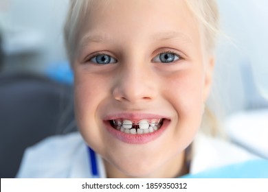 Little blond happy kid girl at dentist office smiling showing diastema overbite teeth missing gap. Child during orthodontist visit and oral cavity check-up. Children tooth care and hygiene