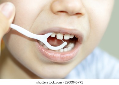 Little Boy Is Cleaning His Teeth With A Toothpick. Plastic Dental Floss.close Up Photo.kid With Diastema Space Between Is Flossing Teeth. Stomatological,dental Care,family Education Healthy