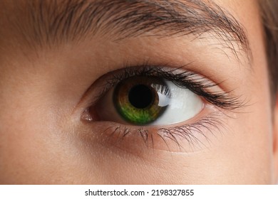 Little Boy With Heterochromia Iridis, Closeup