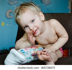 Little Child With Broken Leg. Lifestyle Portrait At The Home.