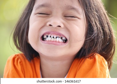 Rotten Teeth Images Stock Photos Vectors Shutterstock