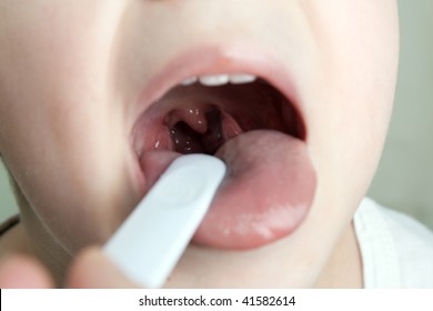 Little Child Patient At Throat Doctor