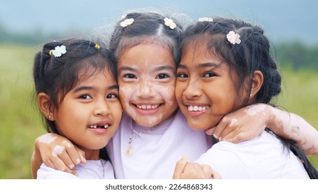 Little cute alpha young albino vitiligo small girl group smile look at camera fun joy hug in meadow field. Melanin face body of asia people gen z kid self love happy diverse of beauty skin care color. - Powered by Shutterstock