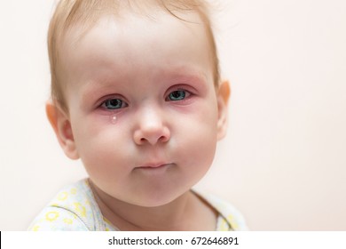 Little cute little girl with red eyes and a tear on her cheek on a white isolated background. Symptoms of the disease