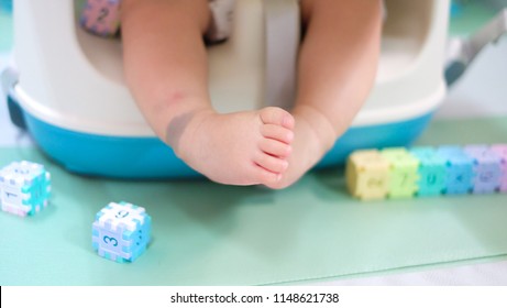 The Little Feet Of Baby Sitting On The Chair With Spot Look Like Stigma (Called 