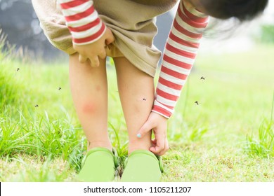 Little girl has allergies with mosquitoes bite and itching her leg.Mosquito blood breeding on kids.Repellent, Dengue virus, Yellow fever, West nile, Malaria, Diseases Spread by Mosquitoes concept.