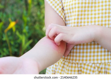 Little Girl Has Skin Rash Allergy And Itchy On Her Arm