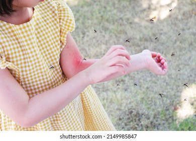 Little girl has skin rash allergy and itchy on her arm from mosquito bite