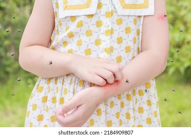 Little girl has skin rash allergy itching and scratching on her arm with mosquitoes bite