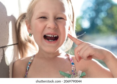 Little Girl Points The Finger At A Wobbly Baby Tooth.