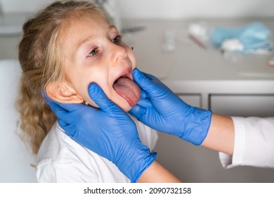 Little Girl At The Reception At The Doctor ENT, Examination Of The Oral Cavity In The Child, Throat