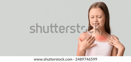 Little girl with red sunburned skin on light background with space for text