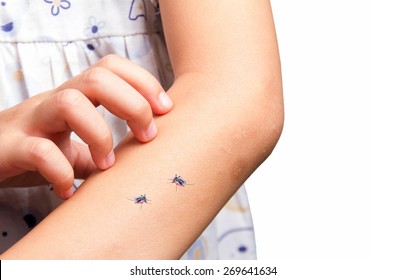 Little Girl Scratching With Mosquito Bite On Her Arm