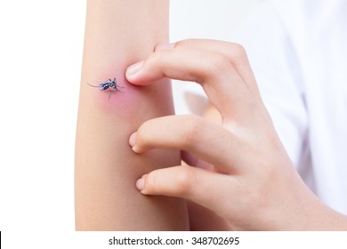 Little Girl Scratching With Mosquito Bite On Her Arm 