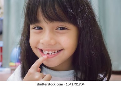 Little Girl Showing Her Broken Milk  Teeth 