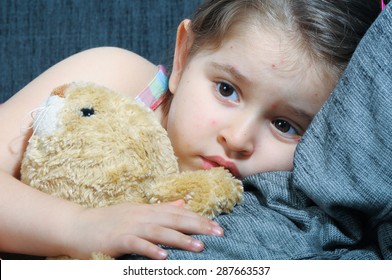 Little Girl With Varicella, Chicken Pox, Small Pox.