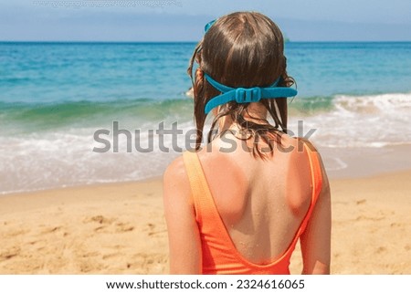 Little girl wearing orange swimsuit and swimming goggles sitting at a beach with sunburn marks on her back