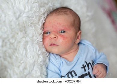 Little Newborn Baby Looking Baby Skin Stock Photo 700239784 | Shutterstock