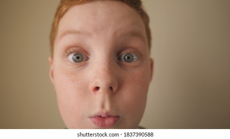 男 顔 シミ の画像 写真素材 ベクター画像 Shutterstock