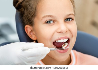 Little smiling girl, teeth check-up. Tooth exam using dental mirror close-up. Child's teeth treatment