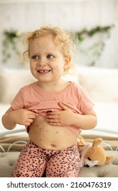 Little toddler girl with chickenpox in bed, playing at home, quarantine isolation during sickness, Varicella zoster virus or Chickenpox bubble rash