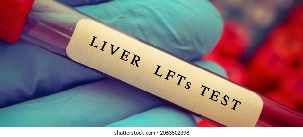 Liver Function Lfts Test Result Blood Stock Photo 2063502398 | Shutterstock