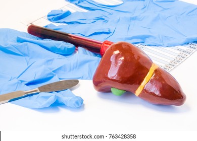Liver and gallbladder biliary surgery concept. Model of liver with gallbladder is near scalpel, surgical gloves and blood test tube with blood result. Indications for surgery and surgical operation