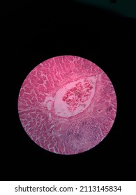 Liver Histology From A Broiler Chicken.