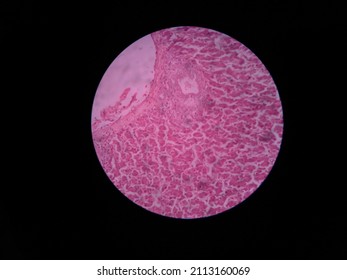 Liver Histology From A Broiler Chicken.