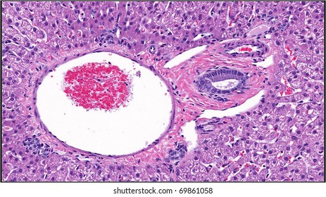 Liver - Portal Area Showing A Bile Duct And Blood Vessel