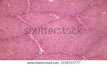 Liver Tissue Under Microscope. Hepatocytes cells form radial sheets, or plates, that may be branched.